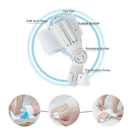 Lphl8VaW9lQy3hDulI6XmDNUwHjl15ol1HJuUbzU.webp Bunion Support Splint. Valgus And Bunion Valgus, Corrector, Hallux Valgus Corrector, Adjustable Bunion Valgus Protective Cover For Men And Women ( default, Standard ).