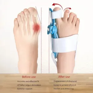 Bunion Support Splint. Valgus And Bunion Valgus, Corrector, Hallux Valgus Corrector, Adjustable Bunion Valgus Protective Cover For Men And Women ( default, Standard ).